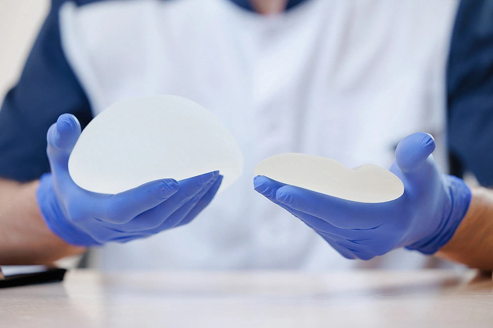 Are Motiva Breast Implants Better Than Traditional Implants?