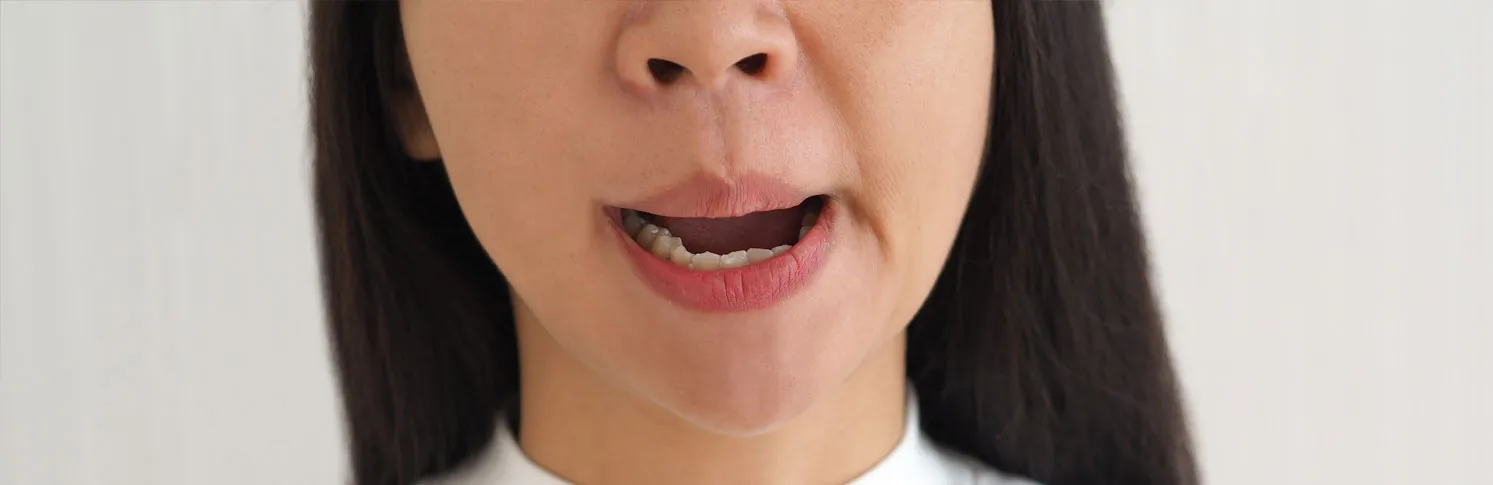 A woman suffering from an asymmetrical jaw
