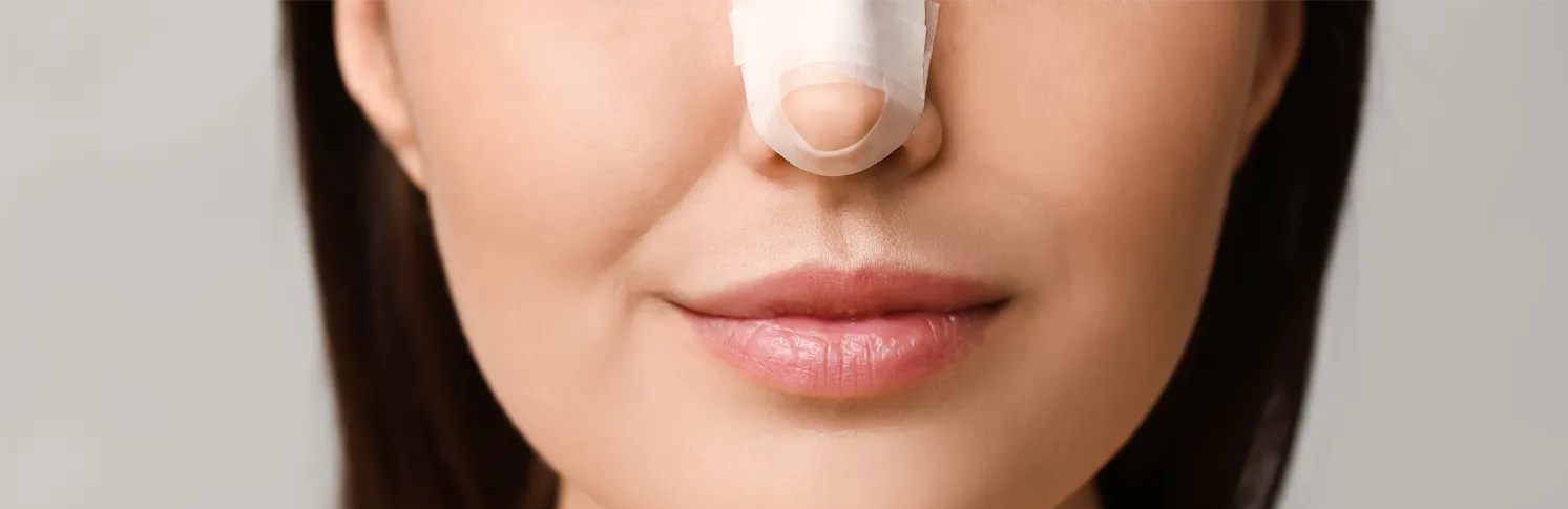 A woman after a rhinoplasty procedure